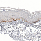 Anti-MLANA Antibody