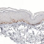 Immunohistochemical staining of human skin shows strong cytoplasmic positivity in melanocytes.