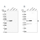 Anti-RRS1 Antibody