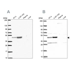 Western blot analysis using Anti-RRS1 antibody HPA055549 (A) shows similar pattern to independent antibody HPA060937 (B).