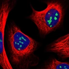 Immunofluorescent staining of human cell line U-2 OS shows localization to nucleoli.