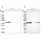 Western blot analysis using Anti-STRAP antibody HPA055557 (A) shows similar pattern to independent antibody HPA073876 (B).