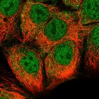 Immunofluorescent staining of human cell line CACO-2 shows localization to nucleoplasm & cytosol.