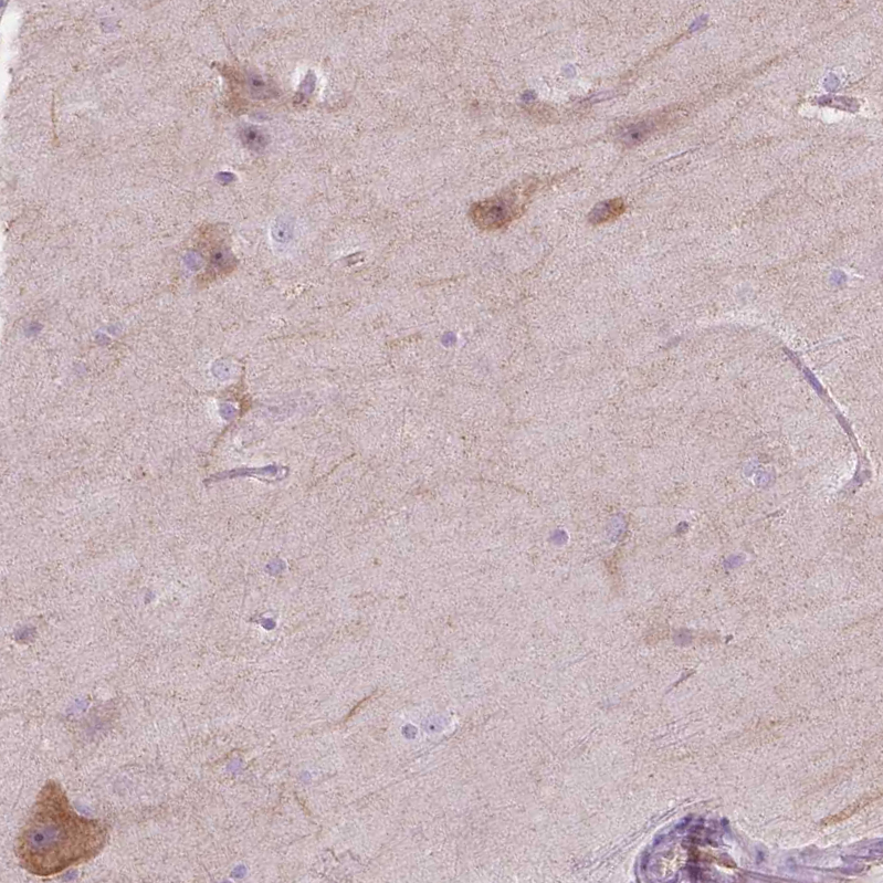 Anti-NOS1AP Antibody