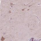 Anti-NOS1AP Antibody