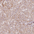 Anti-SLC17A4 Antibody