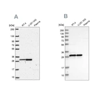 Western blot analysis using Anti-MRPL28 antibody HPA055589 (A) shows similar pattern to independent antibody HPA030594 (B).