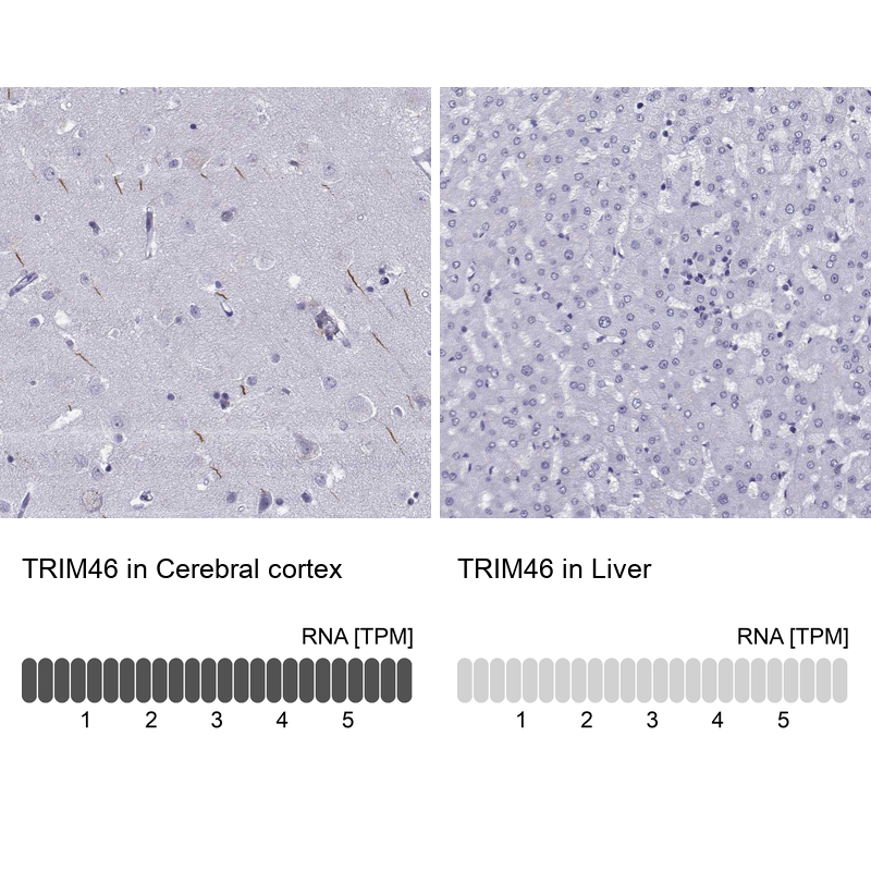 Anti-TRIM46 Antibody