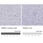 Anti-TRIM46 Antibody