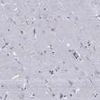 Immunohistochemical staining of human cerebral cortex shows strong cytoplasmic positivity in neuronal projections.