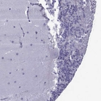 Immunohistochemical staining of human cerebellum shows moderate cytoplasmic positivity in neuronal projections.