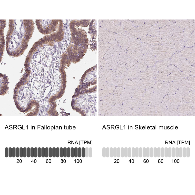 Anti-ASRGL1 Antibody