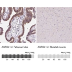 Anti-ASRGL1 Antibody