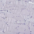 Immunohistochemical staining of human skeletal muscle shows no positivity in myocytes as expected.