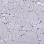 Immunohistochemical staining of human skeletal muscle shows no positivity in myocytes as expected.