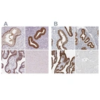 Immunohistochemical staining of human cervix, uterine, endometrium, fallopian tube and skeletal muscle using Anti-ASRGL1 antibody HPA055572 (A) shows similar protein distribution across tissues to independent antibody HPA029725 (B).