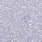 Anti-TRIM46 Antibody