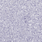 Immunohistochemical staining of human liver shows no positivity in hepatocytes as expected.