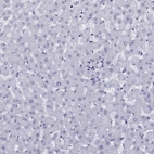 Immunohistochemical staining of human liver shows no positivity in hepatocytes as expected.