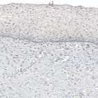 Immunohistochemical staining of human cervix shows no positivity in squamous epithelial cells as expected.