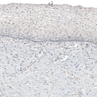 Immunohistochemical staining of human cervix shows no positivity in squamous epithelial cells as expected.