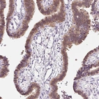 Immunohistochemical staining of human fallopian tube shows moderate to strong cytoplasmic positivity in glandular cells.