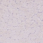 Immunohistochemical staining of human skeletal muscle shows no positivity in myocytes as expected.