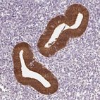 Immunohistochemical staining of human endometrium shows moderate to strong cytoplasmic positivity in glandular cells.