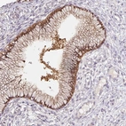Immunohistochemical staining of human cervix, uterine shows moderate to strong cytoplasmic positivity in glandular cells.