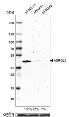 Anti-ASRGL1 Antibody