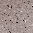 Anti-PRICKLE4 Antibody