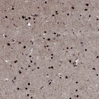 Anti-PRICKLE4 Antibody