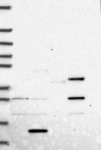 Lane 1: Marker [kDa] 250, 130, 95, 72, 55, 36, 28, 17, 10 | Lane 2: RT4 | Lane 3: U-251 MG | Lane 4: Human Plasma | Lane 5: Liver | Lane 6: Tonsil