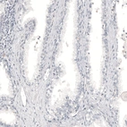 Immunohistochemical staining of human prostate shows no positivity in glandular cells as expected.