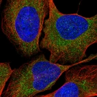 Anti-LTN1 Antibody