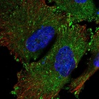 Anti-SRP68 Antibody