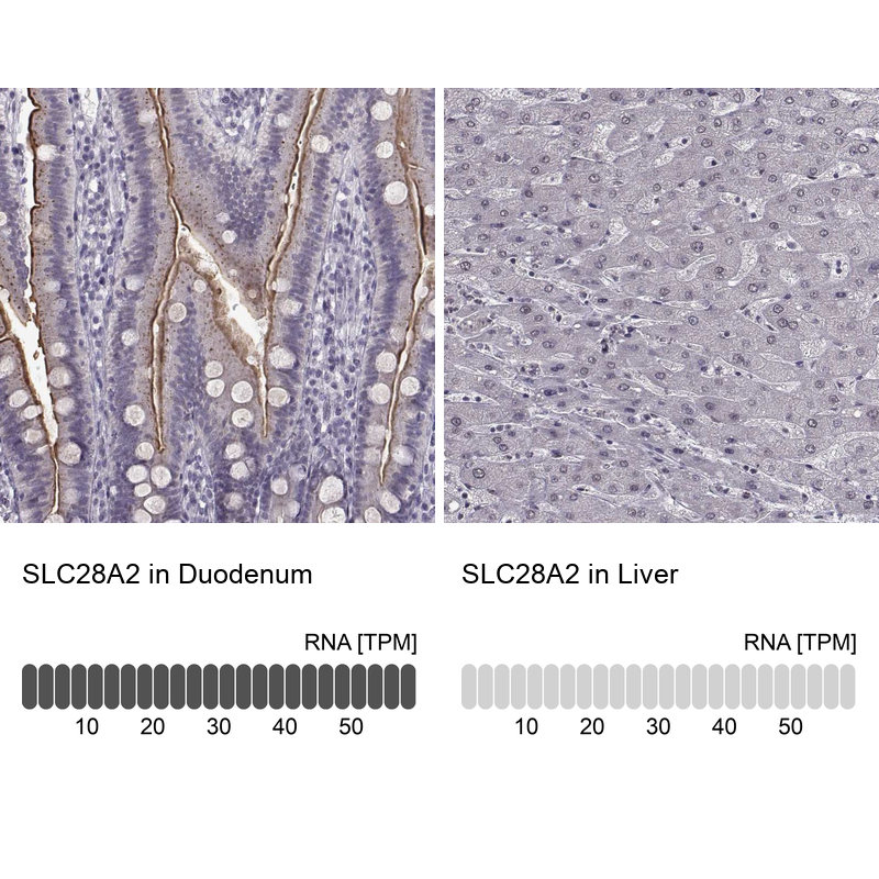 Anti-SLC28A2 Antibody