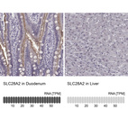 Anti-SLC28A2 Antibody