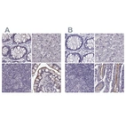 Immunohistochemical staining of human colon, liver, lymph node and small intestine using Anti-SLC28A2 antibody HPA055623 (A) shows similar protein distribution across tissues to independent antibody HPA046068 (B).