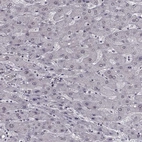 Immunohistochemical staining of human liver shows low expression as expected.