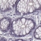 Immunohistochemical staining of human colon using Anti-SLC28A2 antibody HPA055623.