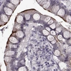 Immunohistochemical staining of human small intestine using Anti-SLC28A2 antibody HPA055623.
