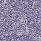 Immunohistochemical staining of human lymph node using Anti-SLC28A2 antibody HPA055623.