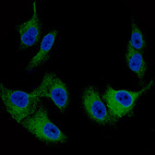 Immunofluorescence staining of SK-MEL-30 cells using the Anti-MART1 monoclonal antibody, showing specific staining in endoplasmic reticulum in green. Nuclear probes are visualized in blue (where available).