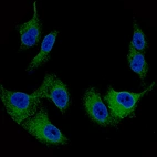 Immunofluorescence staining of SK-MEL-30 cells using the Anti-MART1 monoclonal antibody, showing specific staining in endoplasmic reticulum in green. Nuclear probes are visualized in blue (where available).