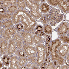 Immunohistochemical staining of human kidney shows moderate to strong cytoplasmic positivity in cells in tubules.