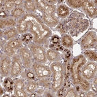 Immunohistochemical staining of human kidney shows moderate to strong cytoplasmic positivity in cells in tubules.