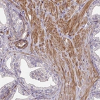 Immunohistochemical staining of human prostate shows moderate cytoplasmic positivity in smooth muscle cells.