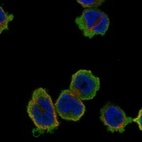 Anti-MMP25 Antibody