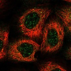 Immunofluorescent staining of human cell line A-431 shows localization to nuclear speckles & cytosol.